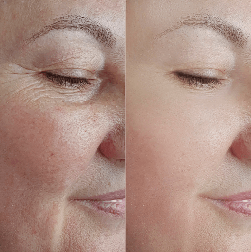 Alura also helps with skin